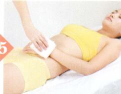 急性腰扭伤拔罐