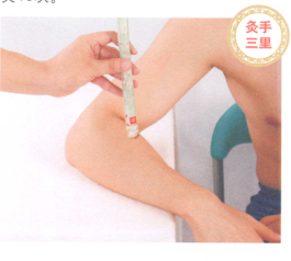 肘关节痛艾灸