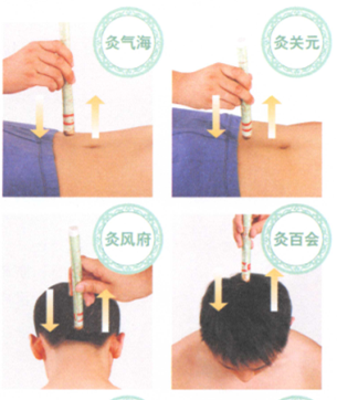 动脉粥样硬化艾灸