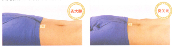 益肾温阳艾灸调理方艾灸