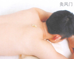 青壮年保健艾灸